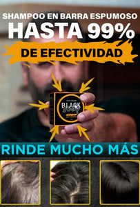 "Adiós Canas: Shampoo Unisex en Barra Black Soap"